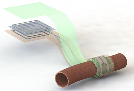 上图描绘了这款可生物降解的压力传感器，它围绕着一根血管，天线在左侧(分离的层状结构，展示了天线结构的细节)